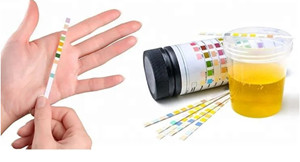 Reagent Strips for Urinalysis Urine Test Strips 10 Parameters Analysis Strips